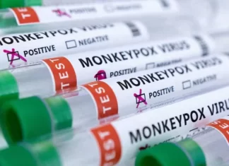 First death from monkeypox in South Africa sparks urgent response