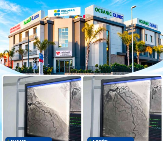 Patient in their 70s receives first-of-its-kind heart treatment in Casablanca A Casablanca clinic has performed the city’s first coronary lithotripsy procedure on a patient in their 70s, expanding advanced heart care.