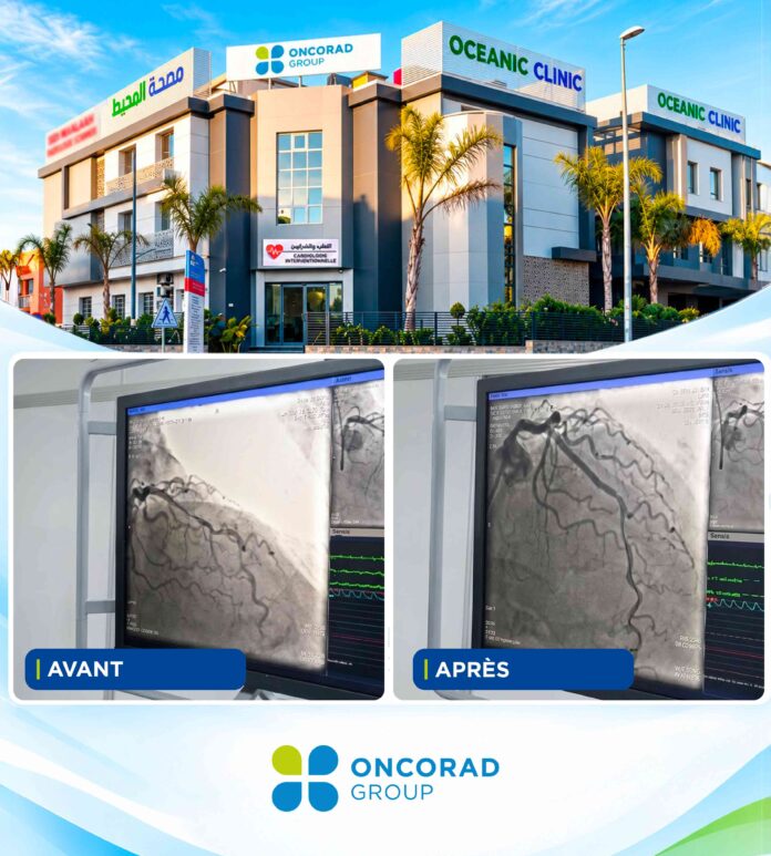 A Casablanca clinic has performed the city’s first coronary lithotripsy procedure on a patient in their 70s, expanding advanced heart care. A Casablanca clinic has performed the city’s first coronary lithotripsy procedure on a patient in their 70s, expanding advanced heart care.